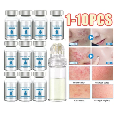 Glamory Micro Infusion System for Face Lips Keep hydrated and Refreshed - Image 1 of 4