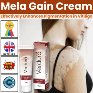 Mela Gain Cream 75gm - White Patches Pigmentation Skin Colour Vitiligo - Picture 1 of 9