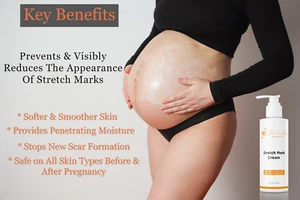 Advanced Stretch Mark Removal Cream | Anti Pregnancy Scar | Post Pregnancy Cream - Picture 1 of 12