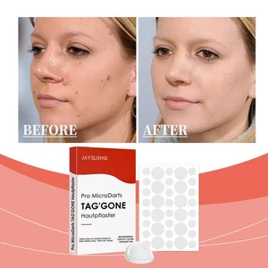 Microneedle Acne Patch Pro Microdarts TAG' GONE Hautpflaster, - Bild 1 von 25