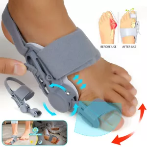 Bunion Corrector for Men and Women, Orthopedic Toe Straightener Hallux Valgus - Picture 1 of 20