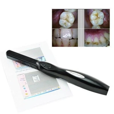 Obtén Cámara dental de alta resolución de 6 MP con 6 LED USB 2.0 para dentistas pacientes Foto 1 de 4