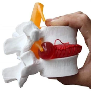 Modelo de demostración lumbar humano con disco herniadora, texturas variadas - Imagen 1 de 6