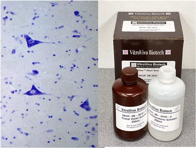 Kit de manchas VitroView™ Nissl (Cat# VB-3010) Foto 1 de 4