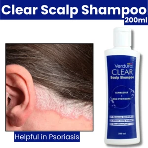 Anti Scaling Scalp Shampoo 200ml - Hydrate Dry Scalp & Reduce Itching - Picture 1 of 9