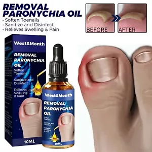 2023 Best German Toenailplus NailProp Anti Paronychia Relief Oil NEW UK - Picture 1 of 13