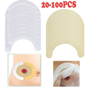 20-100 Stück Stoma Care Fix Tape Spunlaced Tape Kolostomiebeutel Tasche Stoma - Bild 1 von 16