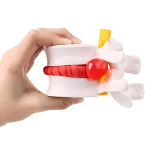 Menschliches anatomisches Bandscheibenvorfallmodell - Lendenwirbelsäulenmodell für Unterricht... - Bild 1 von 6