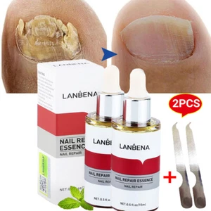 2Pcs Nail Repair Essence Remove Onychomycosis Serum Fungal Nail Treatment Oil - Picture 1 of 16