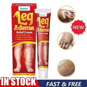 Leg Anti-Oedema Cream - Muscle Swelling Relief Massage Cream - Foot C are - Picture 1 of 13