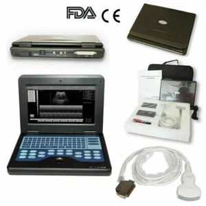 Digitaler Ultraschallscanner tragbarer Laptop-Maschine, 3,5 MHz konvexe Sonde - Picture 1 of 13