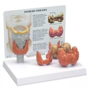 Schilddrüse GPI anatomisches Modell 4-teiliges Set LFA #3150. Machen Sie uns ein Angebot SIEHE VIDEO - Bild 1 von 3