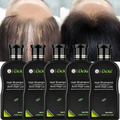 200ml Dexe Hair Growth Shampoo, Hair Loss Shampoo, Fast Hair Thickening Shampoo - Image 1 of 4
