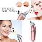 Electric Facial Pore Cleanser Face Blackhead Zit Acne Remover Skin Cleaner # UK