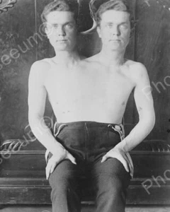 Conjoined Two Headed Man 1901 8x10 Reprint Of Old Photo - Picture 1 of 1