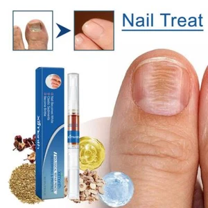Anti Fungal Nail Treatment Pen Finger Toe Care Nail Fungus Fungi Liquid Tool US