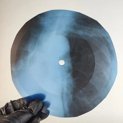 BOB DYLAN NORTH COUNTRY BLUES X-Ray USSR Record Roentgen Bone Ribs Music Vinyl - Image 1 of 2