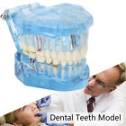 Zähne Modell Blau Teaching Demonstration Simulation Zähne Modell NEW