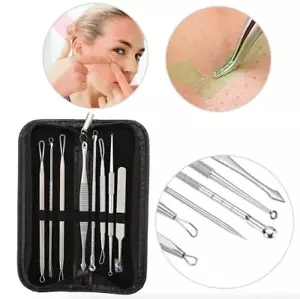 8x BLACKHEAD REMOVER TOOL KIT SPOT ACNE PIMPLE COMEDONE EXTRACTOR POPPER COMEDON - Picture 1 of 9