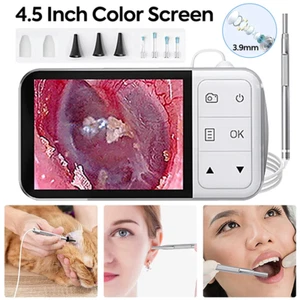 4.5" Screen Digital Otoscope 3.9mm HD Camera Ear Scope Ear Wax Cleaner Tools Kit - Picture 1 of 9