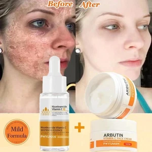 Removedor de manchas oscuras blanqueador facial conjunto corrector de pecas melanina reducir el revestimiento fino - Imagen 1 de 27