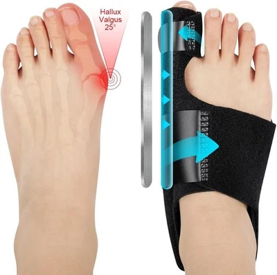 GEBRANDMARKT Hallux Valgus Korrektur Schiene, 2 Korrektur Schiene und 2x Zehenspreizer, ACWOO