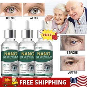 1-3PCS Eye Drops Serum, Natural Lubricant Eye Drops for Dry Eye Presbyopia US - Picture 1 of 14