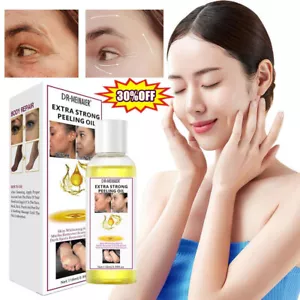 Strong Yellow Peeling Oil Exfoliating Solution for Face Body Dark Skin Hot~ - Picture 1 of 12