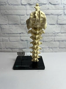St Jude Medical Teaching Sample Display Eon Anatomical Model Lumbal Human Spin - Bild 1 von 23