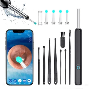 Smart Visual Ear Wax Cleaner with HD Camera – Safe Otoscope Tool Kit - Picture 1 of 6
