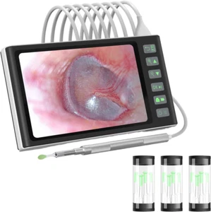 Digital Otoscope with 7.0 Inch Screen, Hiacinto 3.9mm Ear Camera w/ 6 LED Lights - Picture 1 of 11