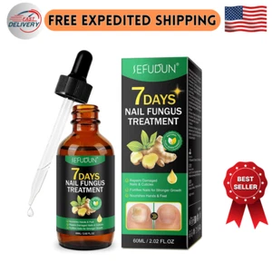7-Day Toenail Fungus Treatment – Extra Strength Repair for Discolored Nails 60ML - Picture 1 of 8
