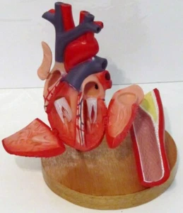 Herz anatomisches Modell Anatomie medizinische Anzeige arterielle Plaque Erkrankung NEU - Bild 1 von 2