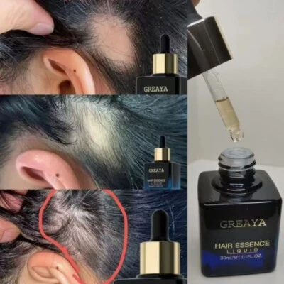GREAYA hair Growth Serum eyebrow hair serum essence 30ML - Image 1 of 4