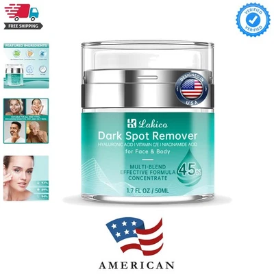 Dark Spot Remover for Face & Body, Dark Spot Corrector- Age Spot Sun Spot Fre... - Image 1 of 4