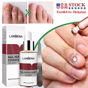 Nail Fungal Treatment Nail Repair Serum Remove Onychomycosis Foot Repair Care - Picture 1 of 10