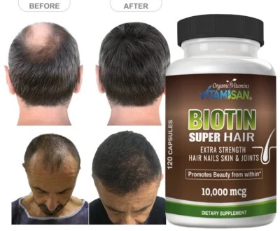 HERBAL HAIR GROW BOOST VITAMINS HELP GROWTH FASTER LONGER THICKER FULLER 120 PIL - Image 1 of 4