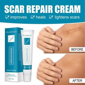 Scar removal Cream Skin Care for Scars Reduce Surgery Acne Stretch Marks NEW
