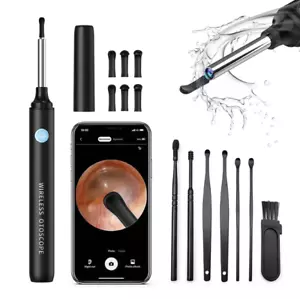 Ohrenschmalz Entferner Otoskop Ohrenreiniger Kamera Wifi Ear Cleaner Camera - Photo 1/11