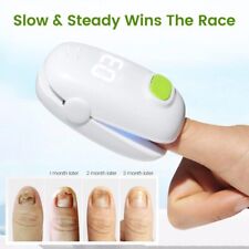 Toe Nail Cleaning Fungus Treatment Cold Laser Device Onychomycosis Therapy 905nm