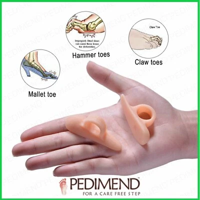 PEDIMEND™ Mallet Toe Gel Straightener, Corrector, Overlapping Separator 1PAIR UK - Image 1 of 4