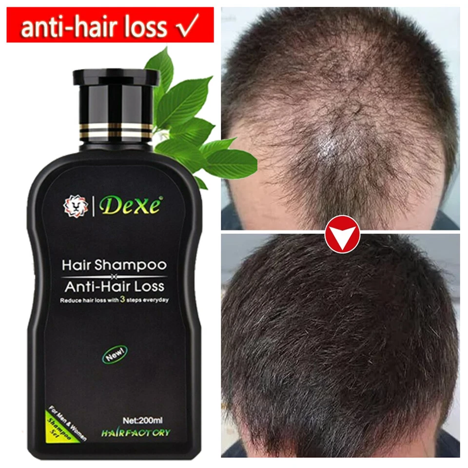 Fast Hair Growth Shampoo For Women Men Anti Hair Loss Treatment Care Thickening~ - Image 1 of 4
