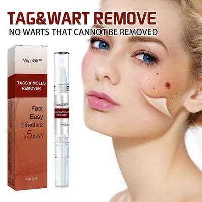 Tags & Moles Remove Wart Treatment Pen Quick Safe Remove Nevi - Image 1 of 4