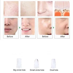 Vacuum Treatment Heads For Facial Diamond Microdermabrasion Vacuum Peel Machine - Picture 1 of 8