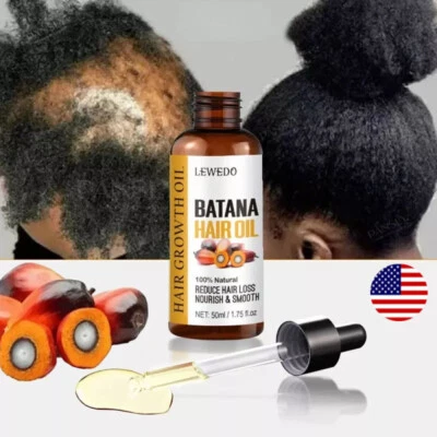 50ml Batana Oil For Healthy Hair Growth Anti-Hair Loss Damaged Hair Root Repair Foto 1 de 4