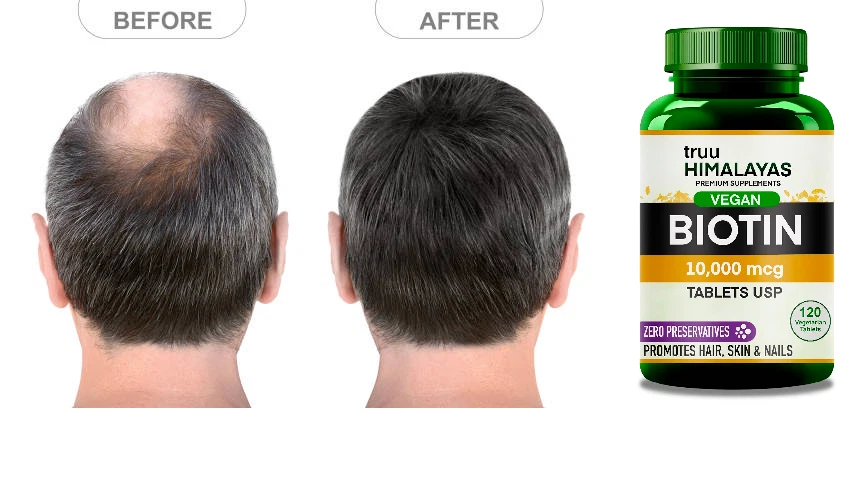 Vitamina B7 Biotina 10000mcg 120 Comprimidos Vegetales, Crecimiento del Cabello, Suplemento Piel y Uñas Foto 1 de 4