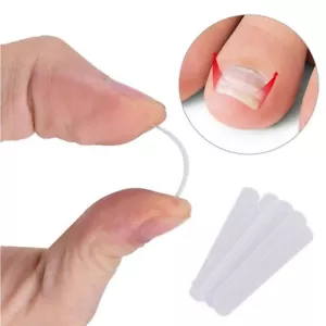 10X Clip de enderezamiento de uñas de los pies Corrección de uñas de los pies BQP REINO UNIDO - Imagen 1 de 2