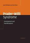 Prader-Willi Syndrome: Development and Manifestations by Joyce Whittington (Engl