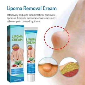 Crema calmante para lipomas 1*20 g ungüento instantáneo para aliviar la incomodidad aglomeración grasa|NUEVA - Imagen 1 de 12
