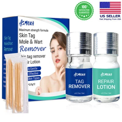 Skin Tag Remover and Repair Lotion Set Mole Corrector Wart Skin Tags Removal Kit - Image 1 of 4